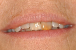 banbury orthodontists