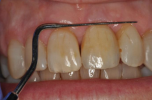 orthodontists banbury