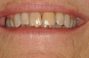 orthodontic treatment in banbury